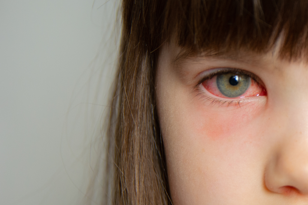 healthy eyes